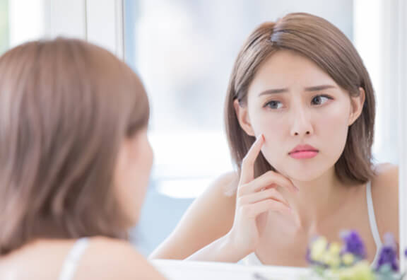 大人ニキビの対策
