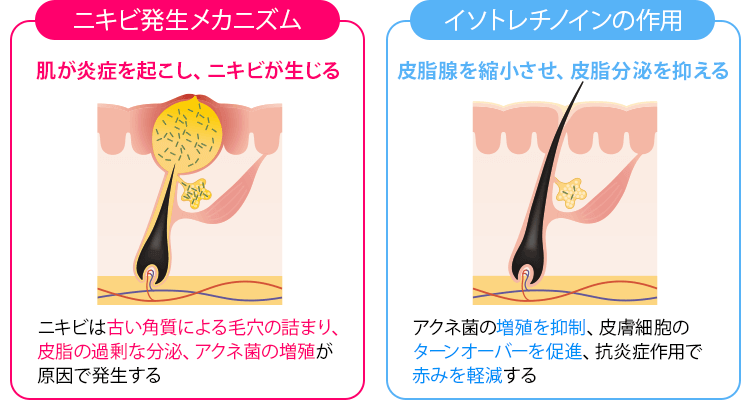 イソトレチノインの作用