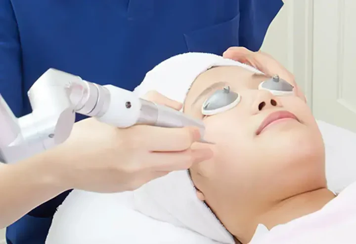 アブレージョン