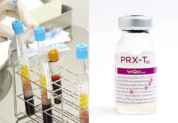 その他の治療方法