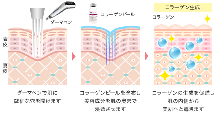 ヴェルベットスキンの仕組み