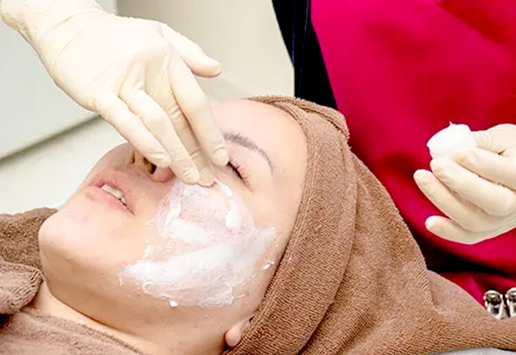 麻酔クリームの塗布