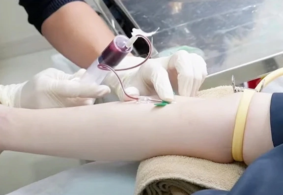 アブレージョン×ACRS