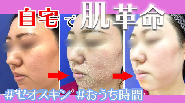 ゼオスキンヘルス （ZO Skin Health） | 渋谷フェミークリニック【渋谷 